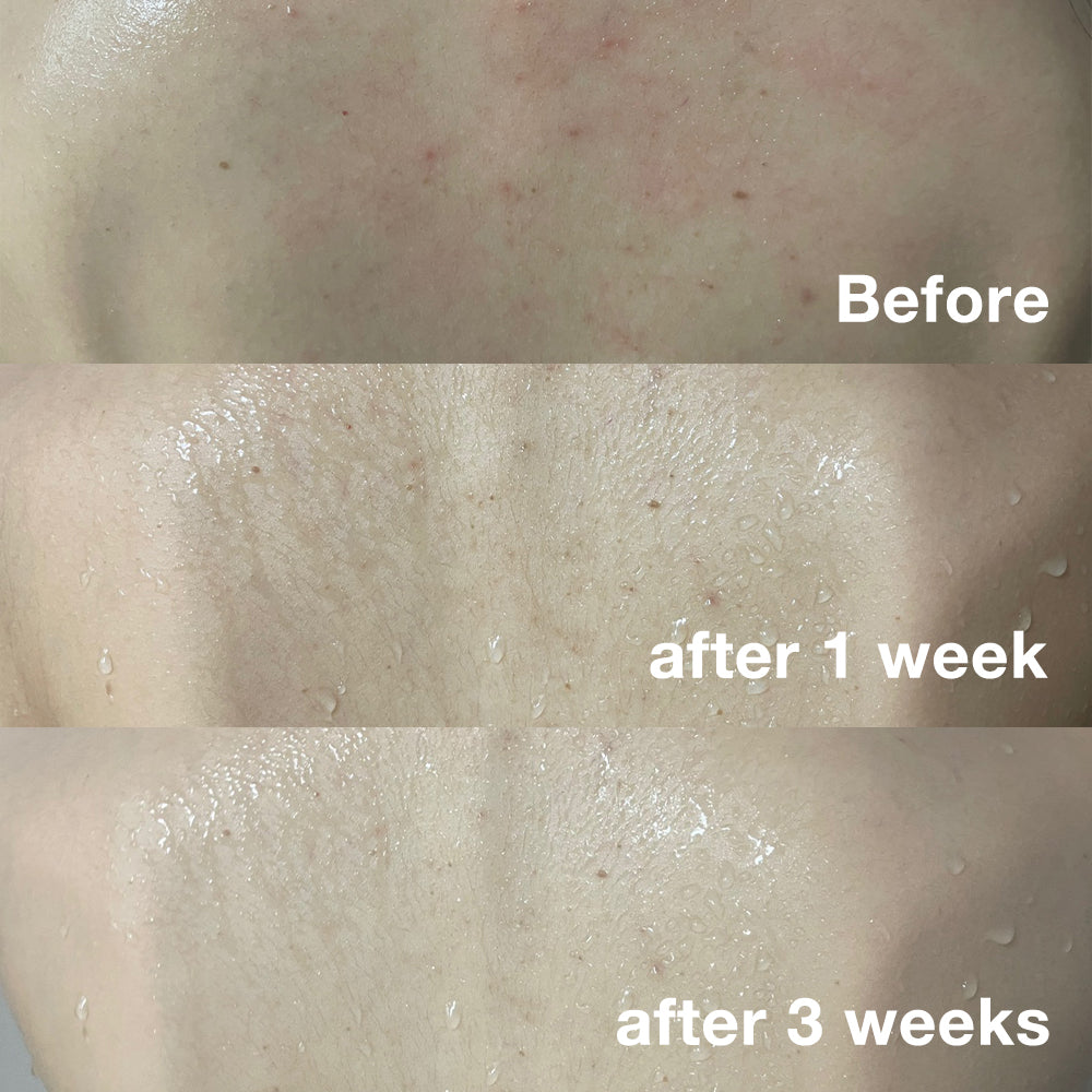 Red Line Total Care Set (Face & Body)